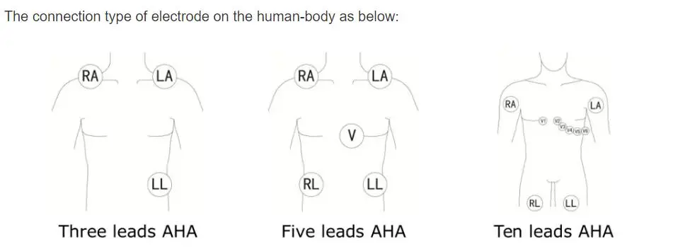 필립스 Digitrak 및 24 시간 홀터 3100A 용 5 리드 ECG 리드선, 5 리드, 스냅